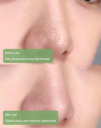 Diystar™  100% Natural Green Tea Deep Cleanse Mask